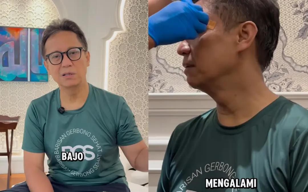 Menteri Kesehatan Budi Gunadi Sadikin Alami Kecelakaan Kecil di Rumahnya
