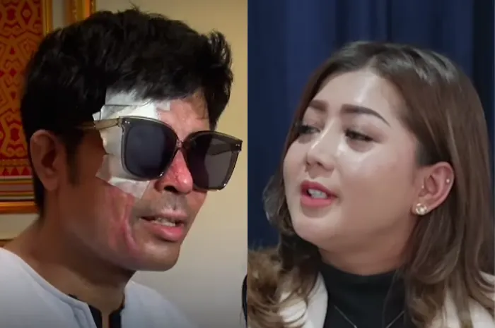 Agus disiram air keras oleh Aji, rekan kerjanya, pada September 2024 lalu. Lalu Novi mengumpulkan iuran dari warganet karena insiden viral.