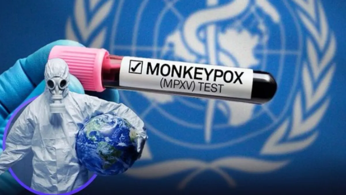 Ilustrasi Mpox atau Monkeypox atau Cacar Monyet