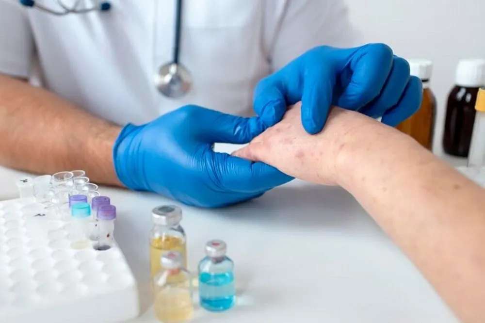 Virus cacar monyet ini sudah mulai masuk di Indonesia pada 2022 hingga 2024 telah tercatat 88 kasus yang terkonfirmasi virus Mpox.