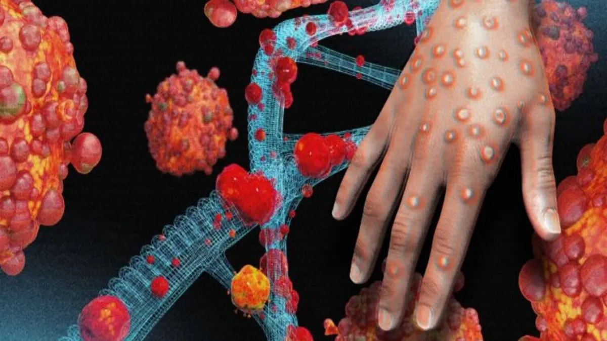 Ilustrasi Virus Monkeypox atau Mpox atau Cacar Monyet