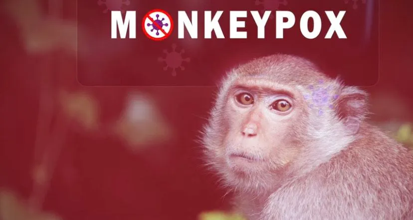 Ilusttrasi Monkeypox atau Mpox atau Cacar Monyet
