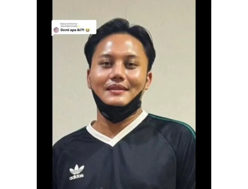 Rizky Febian Diduga Lakukan Operasi Hidung
