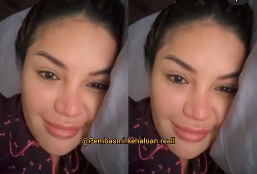 Nikita Mirzani Sindir Rekan Artis yang Alasan Operasi Hidung karena Sinus