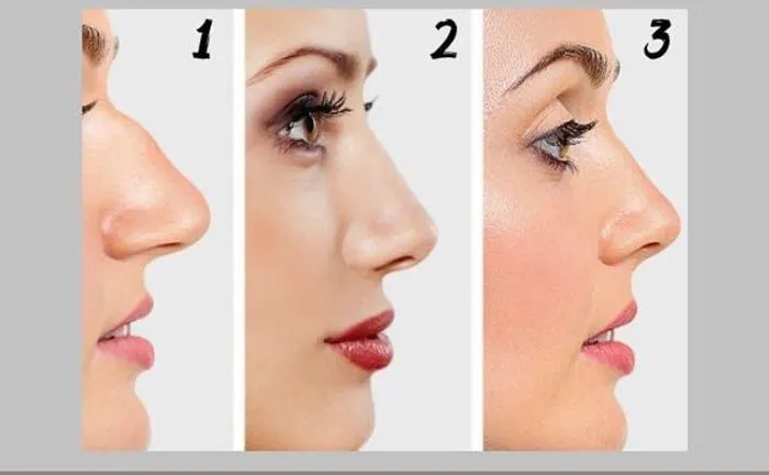 Mengulik Karakter Tersembunyi yang Kamu Miliki Berdasarkan Bentuk Hidung, Pekerja Keras atau Boros?