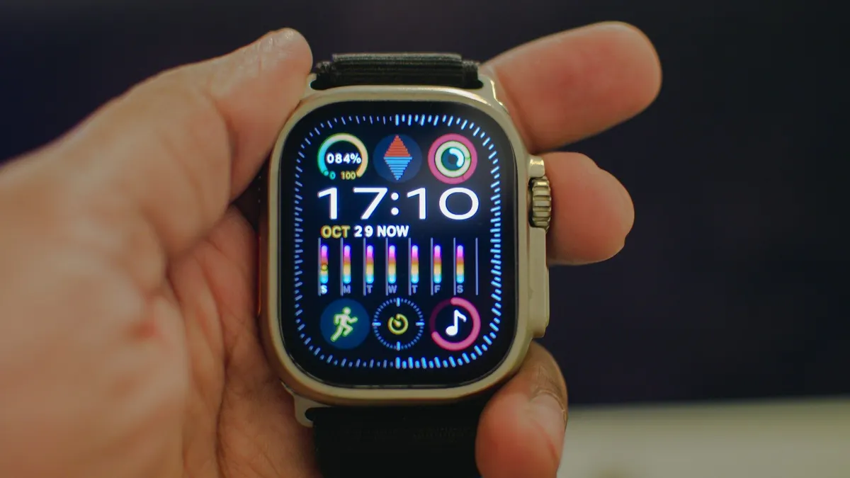 Ilustrasi. Smartwatch