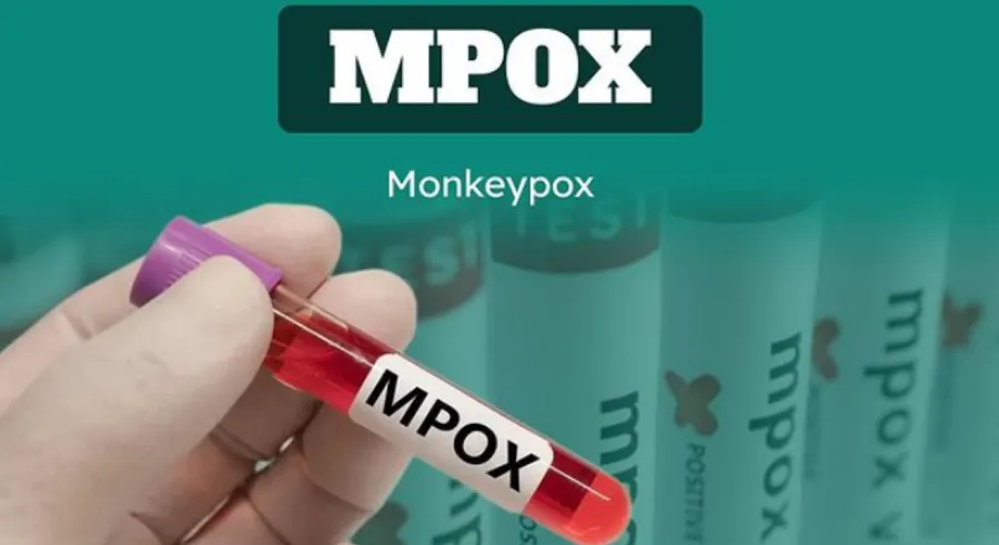 Menjadi sorotan usai ditetapkan WHO sebagai Darurat Global, potensi penyebaran virus Monkeypox atau Mpox kini menuai perhatian masyarakat.