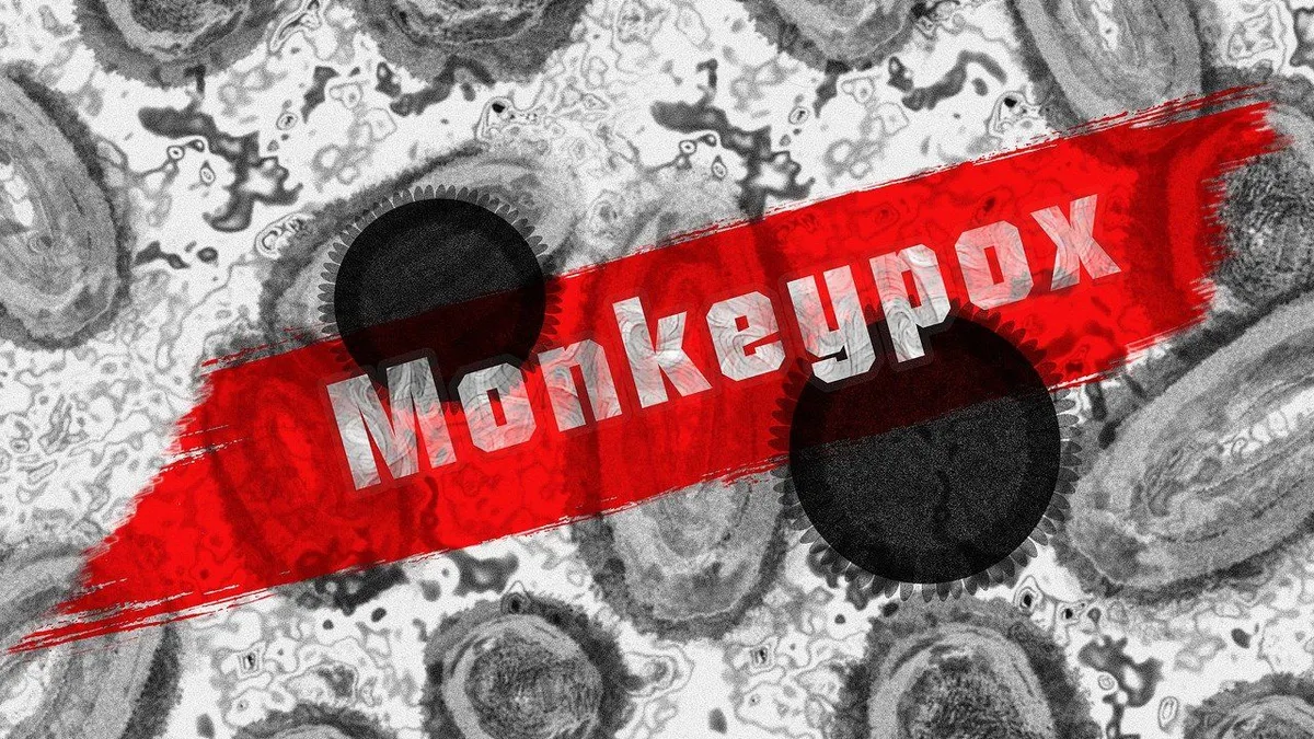 Ilustrasi penularan virus Mpox.