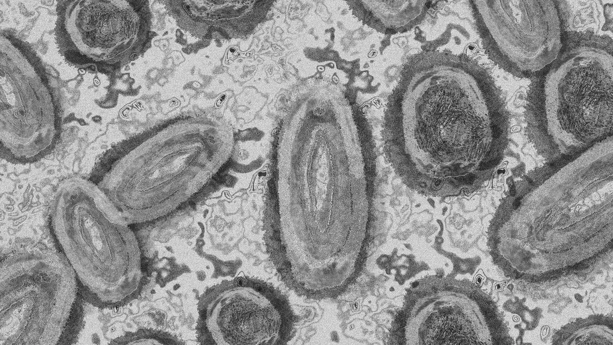 Penularan mpox atau cacar monyet biasanya terjadi melalui kontak fisik langsung dengan hewan terinfeksi, terutama pengerat dan primata.