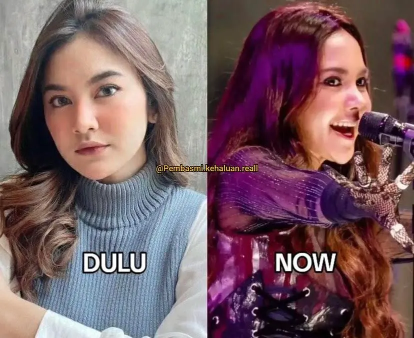 Mahalini Raharja ramai disebut operasi hidung