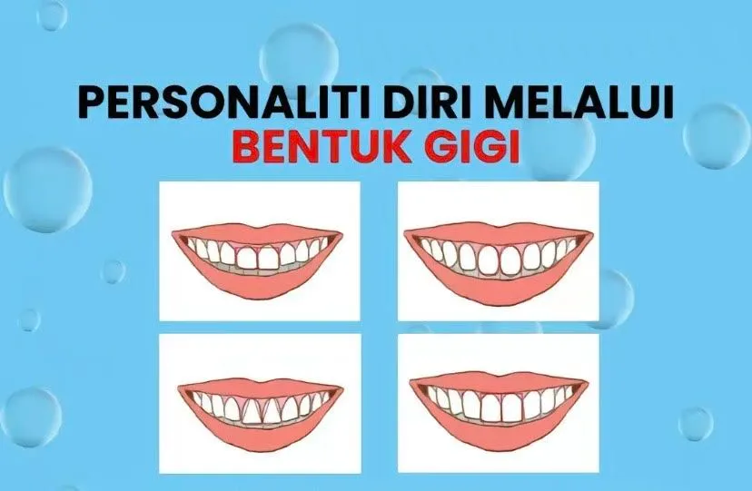 Ilustrasi Tes Kepribadian Berdasarkan Bentuk Gigi