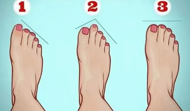 Ilustrasi tes kepribadian