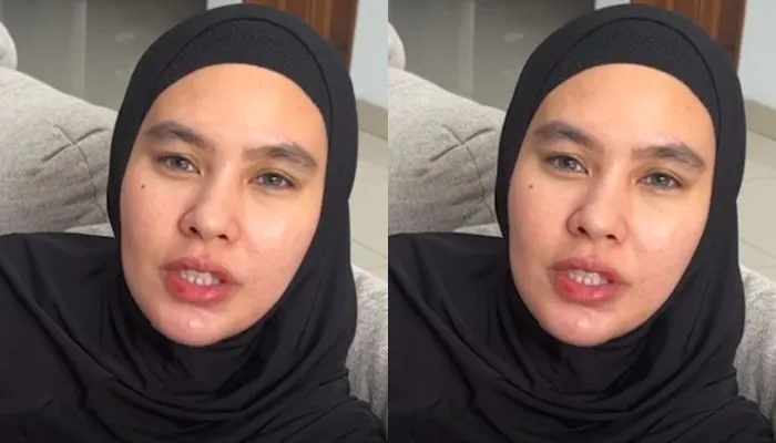 Potret Kartika Putri sedang mengalami sakit wajah dan lidah yang melepuh.