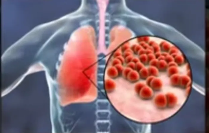 Kasus Pneumonia Akut Menyerang Tiongkok dan Belanda, Ahli Epidemiologi Paparkan Sejumlah Cara Pencegahan