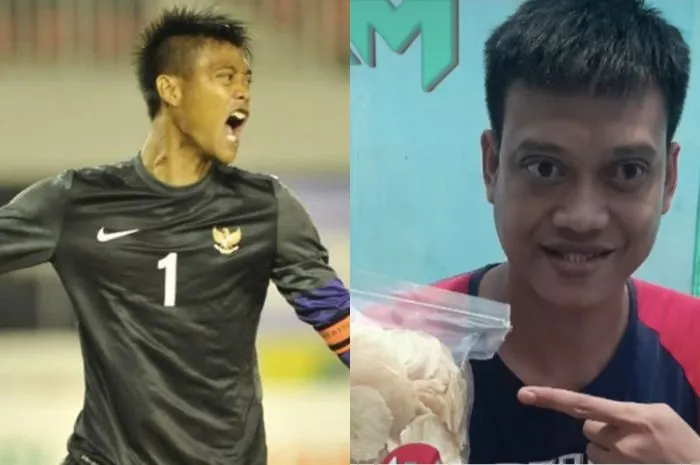 Selama tujuh tahun terakhir, Kurnia Meiga yang merupakan mantan kiper Timnas Indonesia menderita penyakit Papilledema.