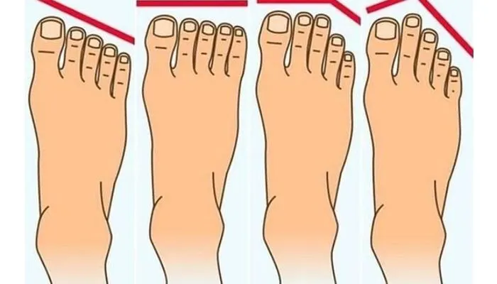 Bentuk kaki bisa ungkap kepribadian seseorang