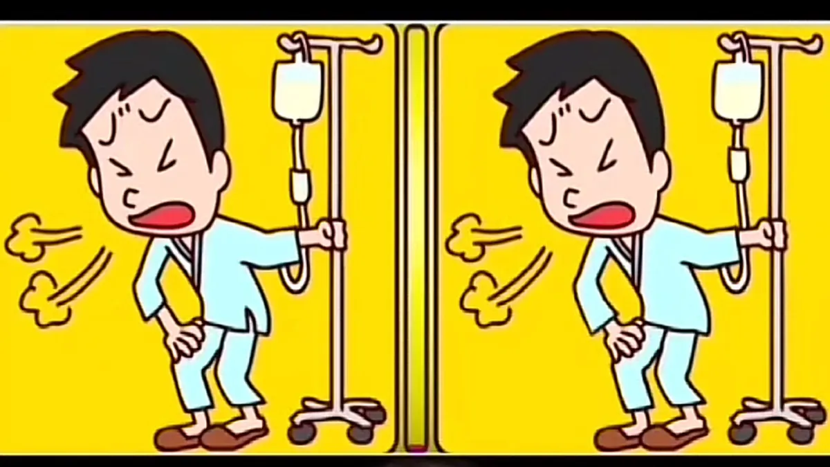 Tes IQ: Temukan 3 Perbedaan di Gambar Ini dalam Waktu 10 Detik