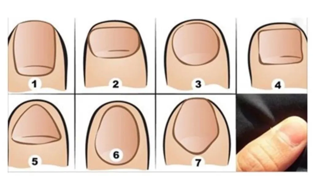 Ungkap Kepribadian Tersembunyi dari Bentuk Kuku Jempol Tangan, Nomor 5 Paling Langka! (shopee @socialfeedsticker)