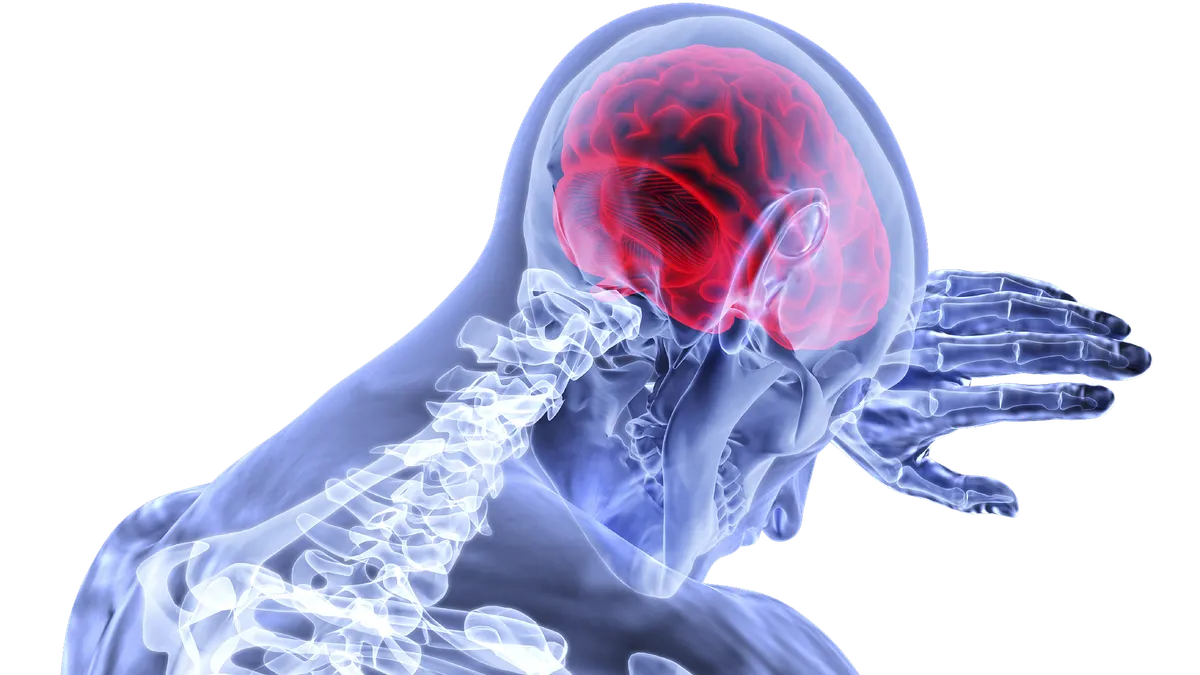 Gejala Stroke