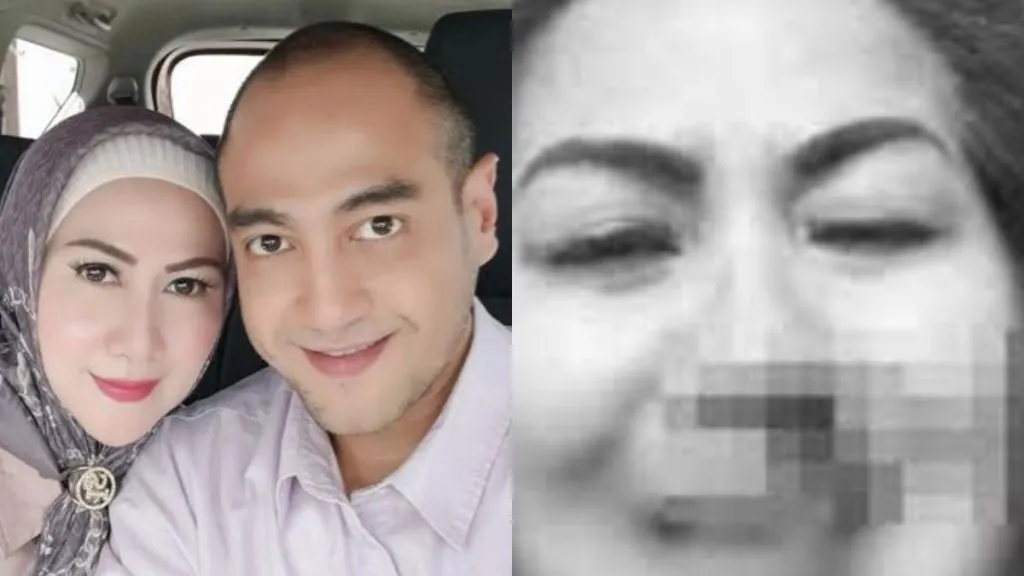 Keaslian Foto Berdarah-Darah Venna Melinda Diragukan Oleh Pakar Telematika, ini Tanggapan Hotman Paris Hutapea