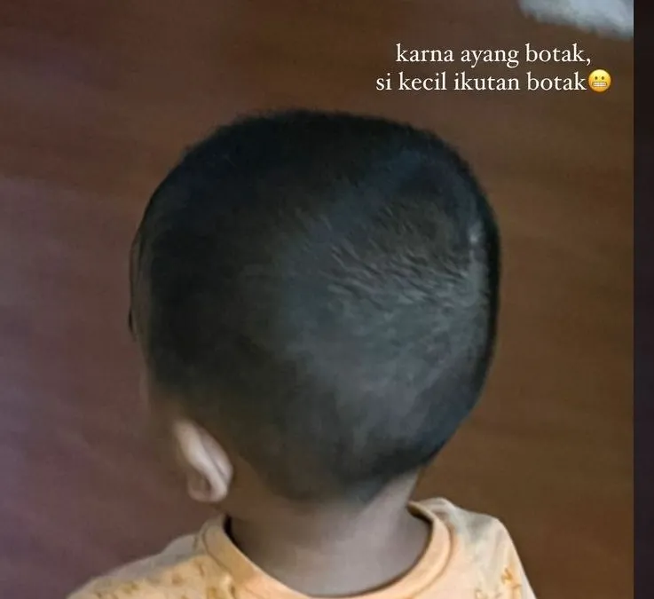 Anak Ferdy Sambo dan Putri Candrawathi Akhirnya Diadopsi oleh Keluarga Brigadir J, Benarkah?