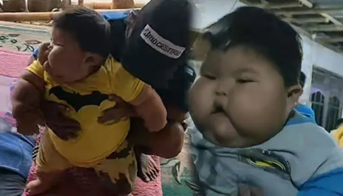 Viral! Bayi 1 Tahun dengan Berat 25 Kg, Medis Jelaskan Berat Badan Ideal Bayi Seharusnya.. 