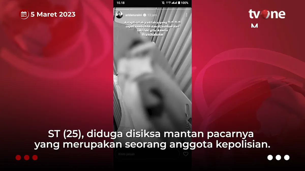 Update Oknum Polisi Viral Siksa Mantan Pacar, Sahabat Korban Ungkap Kronologi Kejadian Kejinya Berdarah-darah