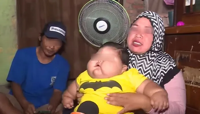 Potret Bayi 16 Bulan 27 Kilogram