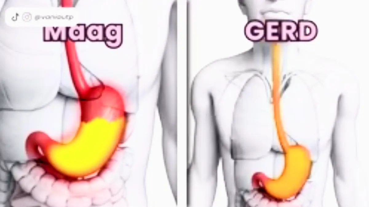 illustrasi Magh dan Gerd