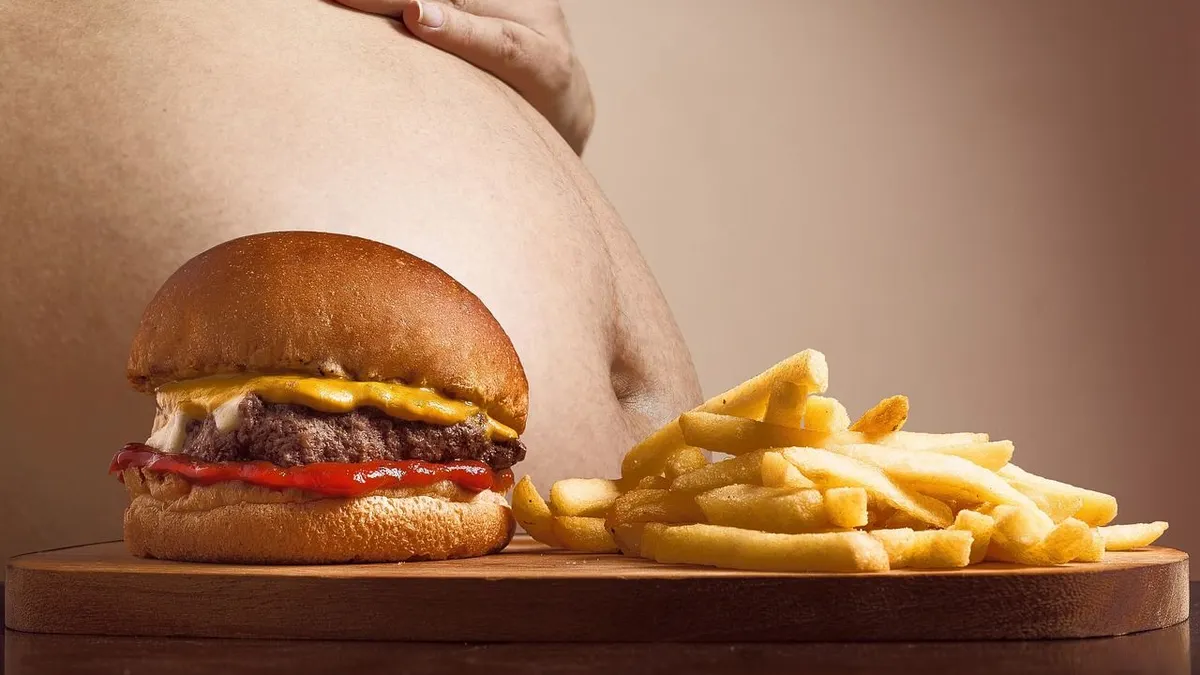Illustrasi. Obesitas