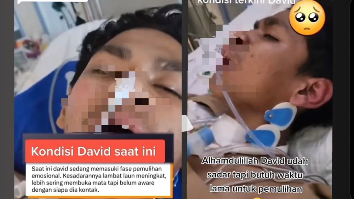 Update Keadaan David Korban Kasus Penganiayaan 