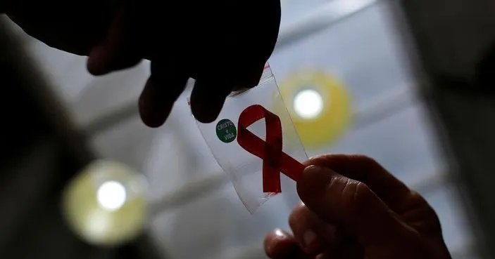 HIV AIDS