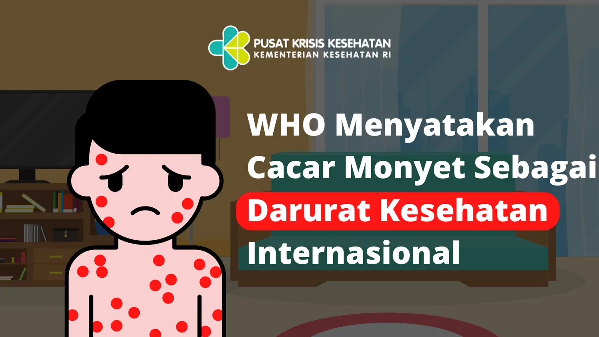 Cacar monyet ditetapkan WHO sebagai Darurat Kesehatan Internasional.