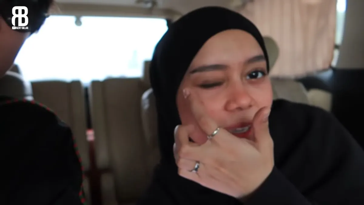 Unggahan lawas Lesti Kejora yang sedang memamerkan luka lebam di matanya.
