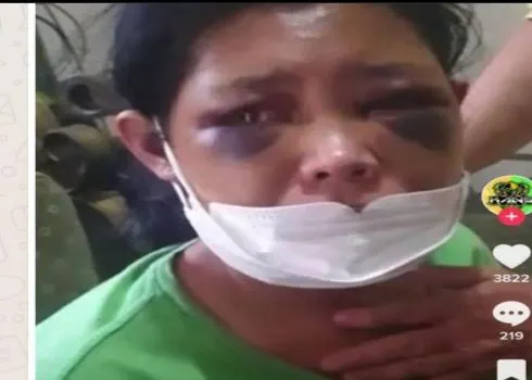 Viral! Dugaan Kasus Penganiayaan ART di Bandung, Hotman Paris Minta Kasus Ditarik ke Polda Jabar!