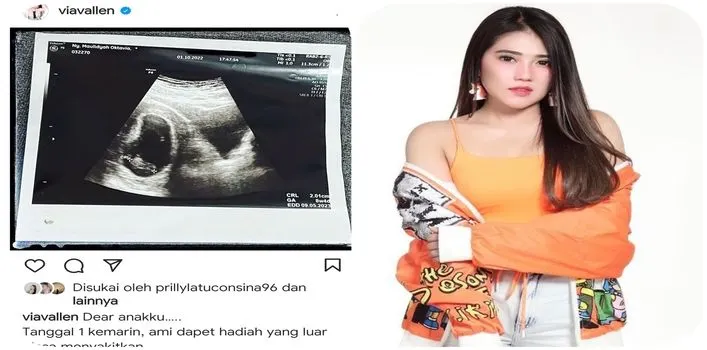 Berharap Jantung Janin Dalam Kandungannya Berdetak, Via Vallen: Hari ke-7 Masih Sunyi/ Instagram @viavallen