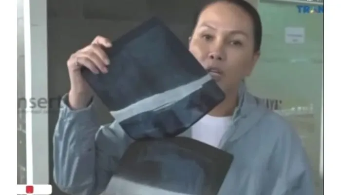 Warganet Tuding Nikita Mirzani Masuk RS Hanya Muslihat Semata, Fitri Salhuteru Ungkap Bukti Rontgen Sahabat