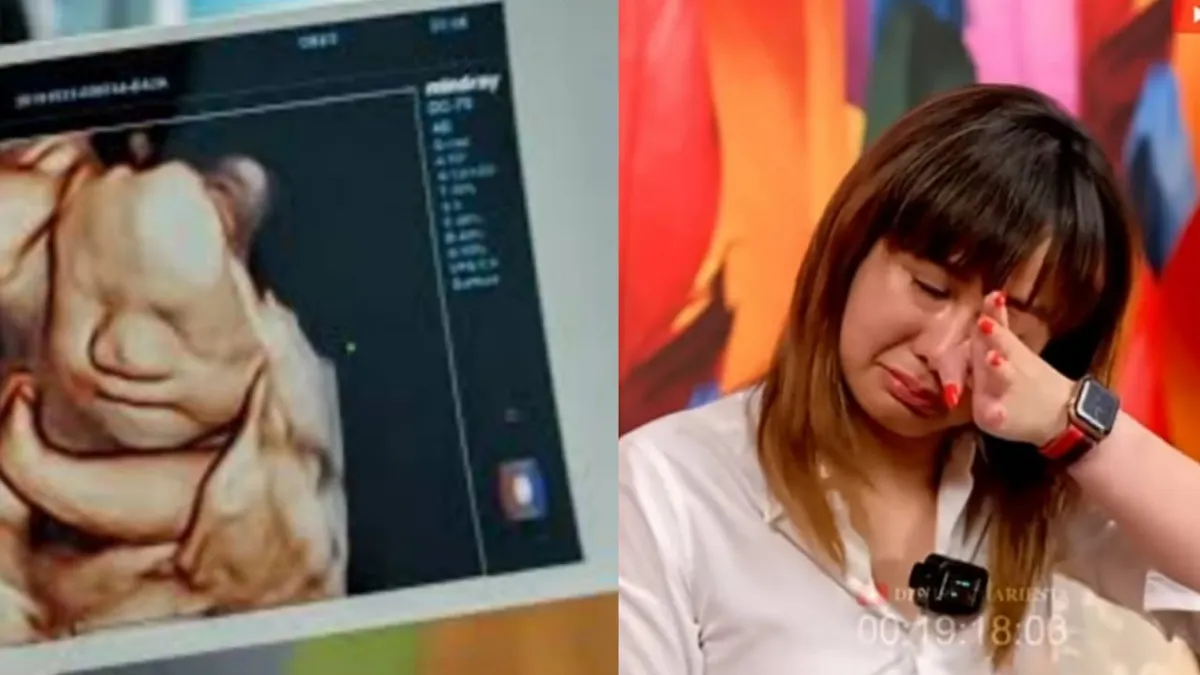 Ilustrasi: Semakin Berani, Denise Chariesta Kini Pamer Foto USG dengan Selingkuhannya Pria Berinisial RD