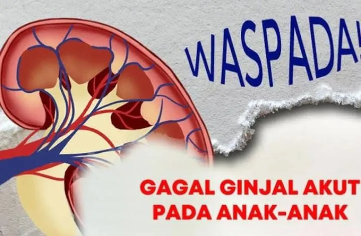 BPKM akan mendampingi korban gagal ginjal akut anak