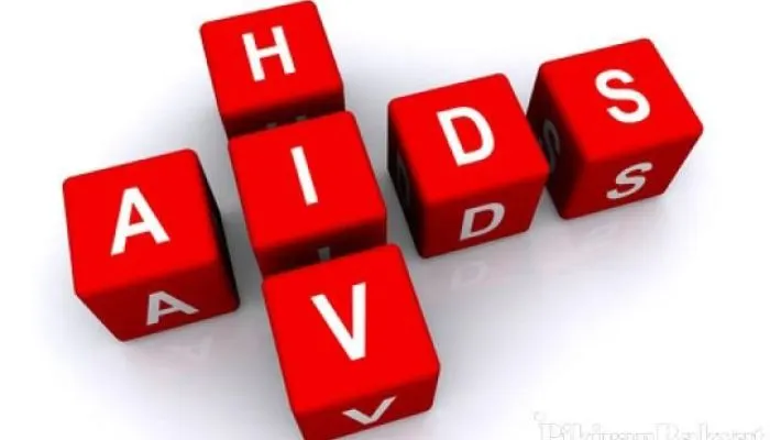 hiv aids
