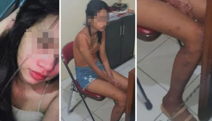 Cancel Cewek MiChat karena Tak Sesuai Foto, Polisi Pengamanan G20 di Bali Tewas Ditusuk, Begini Kronologinya