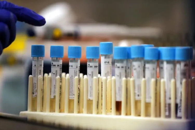 Pengecekan pasien dengan metode polymerase chain reaction atau PCR (ilustrasi). Foto: AP Photo/Gerald Herbert