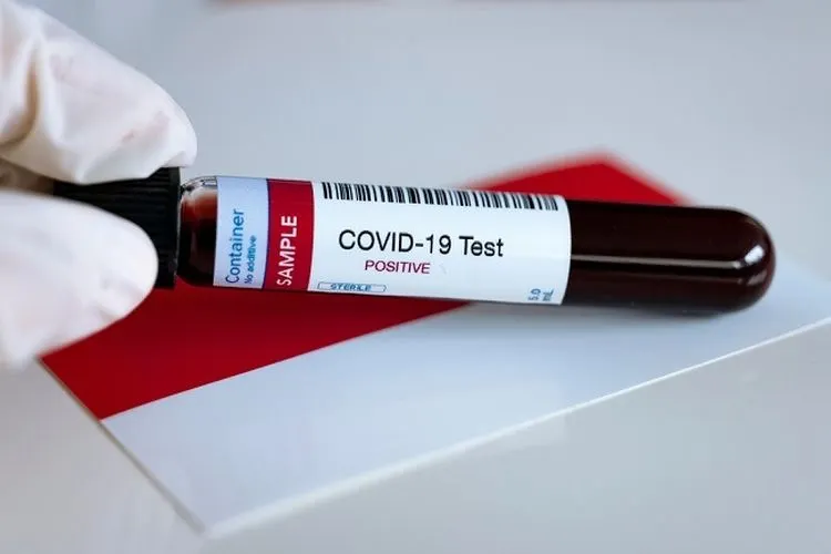 Ilustrasi tes COVID-19. (alodokter.com)