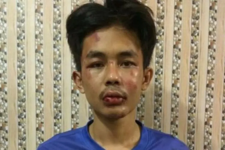 Alpin Andria, pelaku penyerangan terhadap Syekh Ali Jaber/ dok