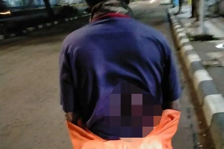 Luka di tubuh Suminan yang menjadi korban perampokan bersenjata motor dan ponselnya di Jalan Letjen Suprato, Cempaka Putih, Jakarta Pusat, pada Rabu (26/2/2020) lalu. (Instagram)