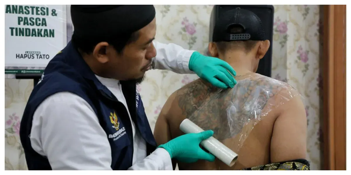 Proses Hapus Tato (Sumber: beritajakarta.id/ Andri Widiyanto)