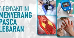 Dokter Spesialis Penyakit Dalam Ungkap Jenis Gangguan Kesehatan yang Selalu Meningkat Pasca Perayaan Idul Fitri