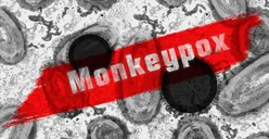 Waspada! 88 Kasus Mpox Ditemukan di Indonesia, Kenali Cara Penularan Cacar Monyet dan Pencegahannya