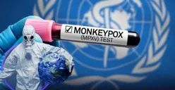 Jakarta Tercatat Jadi Daerah Paling Tinggi Persebaran Virus Mpox di Indonesia, Ini Jumlah Kasus yang Berhasil Ditangani