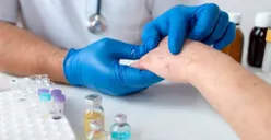 WASPADA! Mpox di Indonesia Terus Meningkat, Berikut 6 Kategori Orang yang Harus Diperiksa Cacar Monyet
